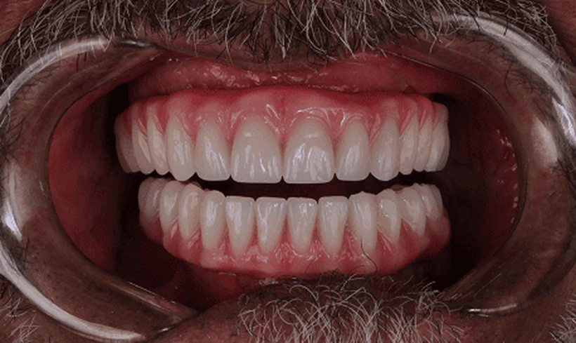 Depois: função e estética devolvidas
