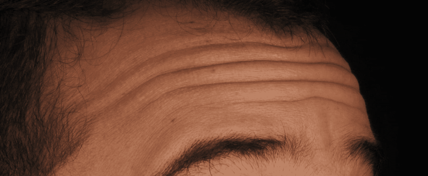 foto protese Dr Paulo Cardoso Reabilitação Oral