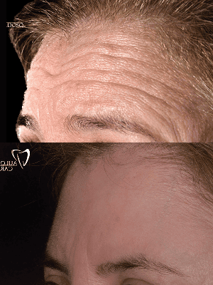 foto protese Dr Paulo Cardoso Reabilitação Oral