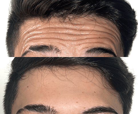 foto protese Dr Paulo Cardoso Reabilitação Oral