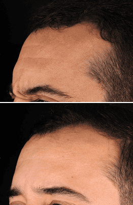 foto protese Dr Paulo Cardoso Reabilitação Oral